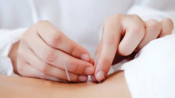 How Acupuncture Can Help with Chronic Pain Management
